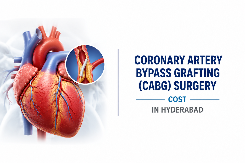 Cover image — Coronary Artery Bypass Grafting (CABG) Surgery Cost in Hyderabad